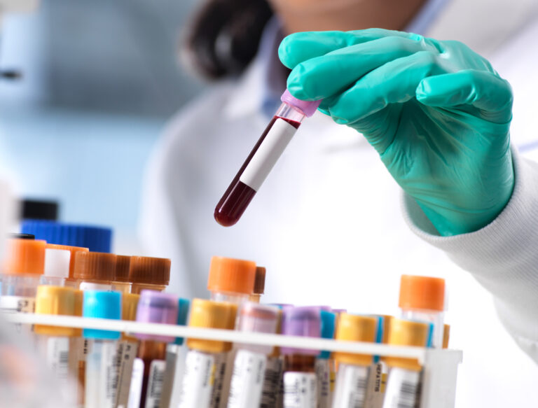 Health Optimization | Lifespan Health 4 Organizing Test Tubes edited