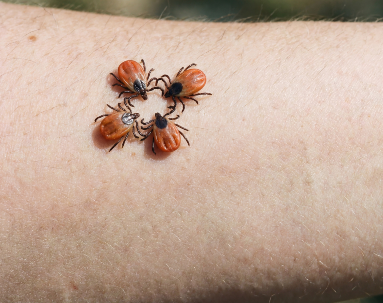 Group of ticks on an arm