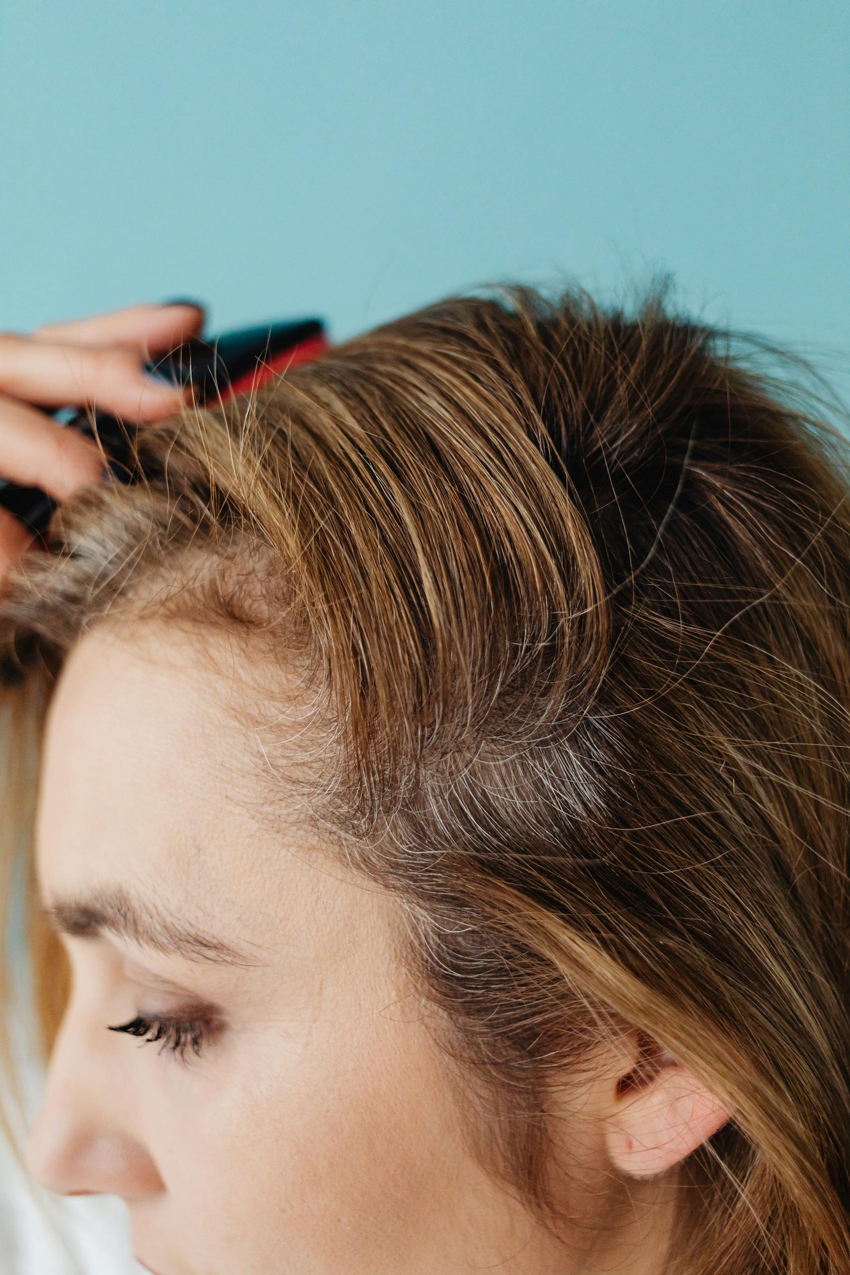Close-up of a woman brushing her thinning hair to represent Lifespan Hair Restoration